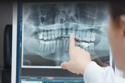 Dentist reviewing digital dental scans on screen and pointing