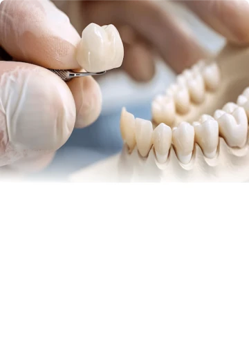 Dental crown restoration illustrated to represent restorative treatment pricing.
