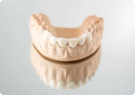 dental crown
