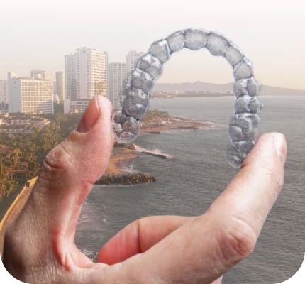 Invisalign aligners at My Smile dental clinic in San Diego