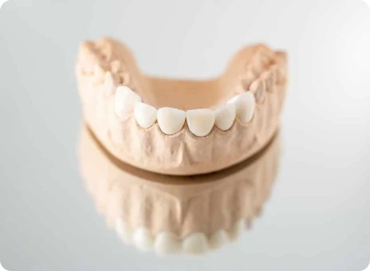 Dental Crowns: A Complete Guide to Restoring Your Smile