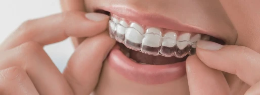 Dentist preparing custom clear aligners for a patient's orthodontic treatment.