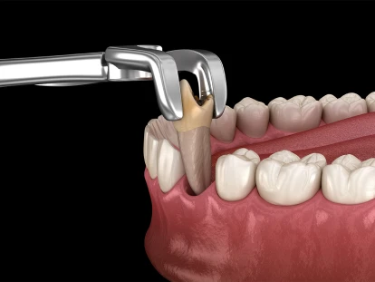Standard dental extraction procedure for damaged teeth, performed by licensed dentists in San Diego.