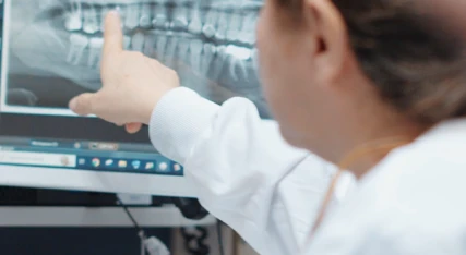 Dentist reviewing a detailed dental X-ray at our modern clinic. Personalized treatments at My Smile Clinic San Diego.